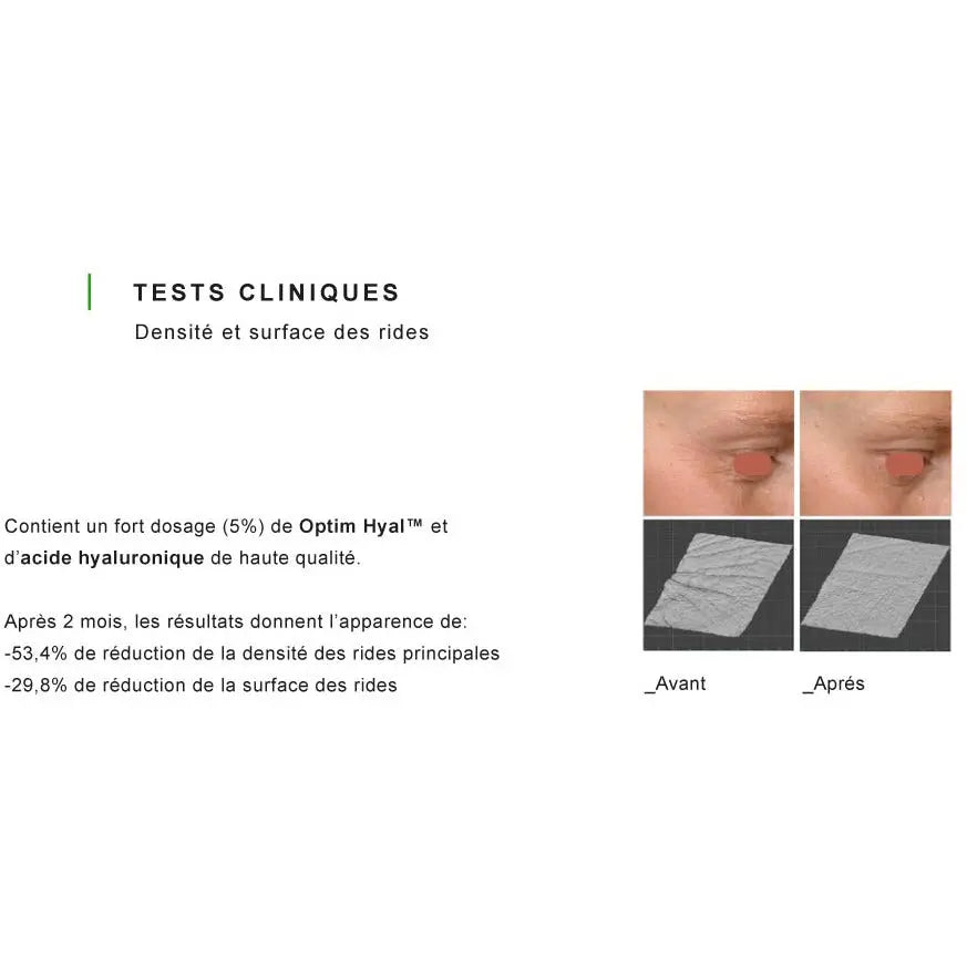 Acide Hyaluronique